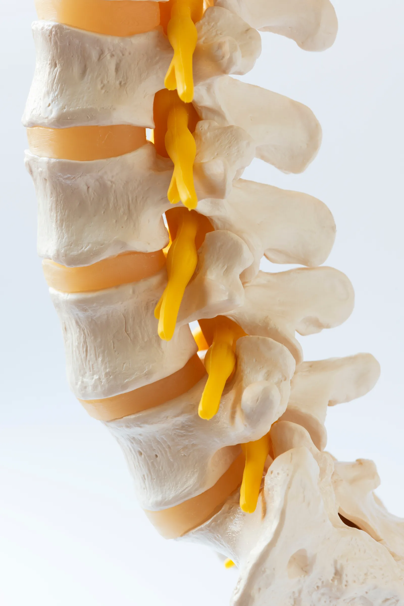 Degenerative Disc Disease Ddd Causes Symptoms Treatment Options Orthopaedic Specialists Of