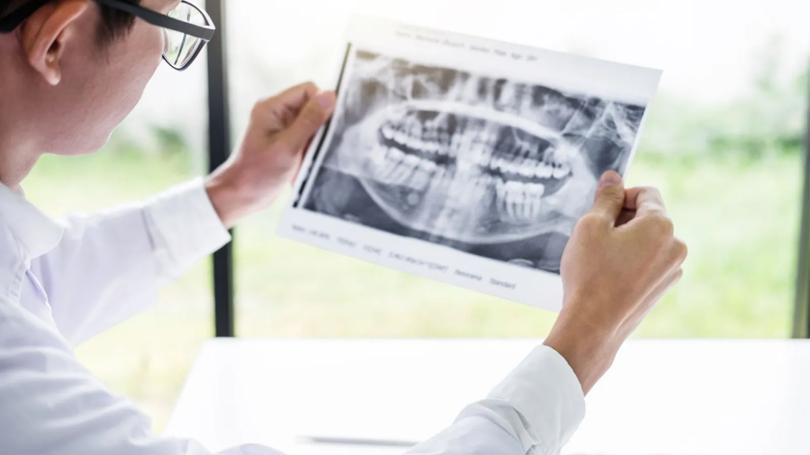 Dentist examining dental X-ray with teeth details, bright natural light in the background.