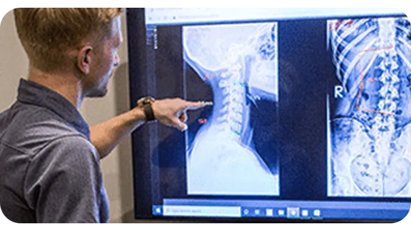 Doctor examining cervical spine and thoracic spine X-rays on a digital screen with detailed vertebrae images.
