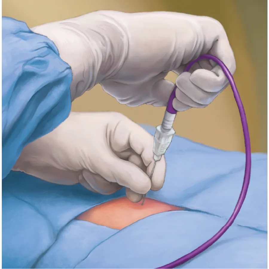 Medical professional performing a procedure with a needle on a patient in a clinical setting.