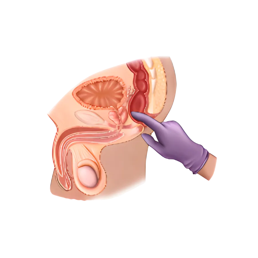 Gloved hand demonstrating male anatomy in a detailed cross-section medical model.