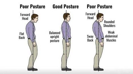 What Is Good Posture? - Equilibrium Sports and Spinal Clinic