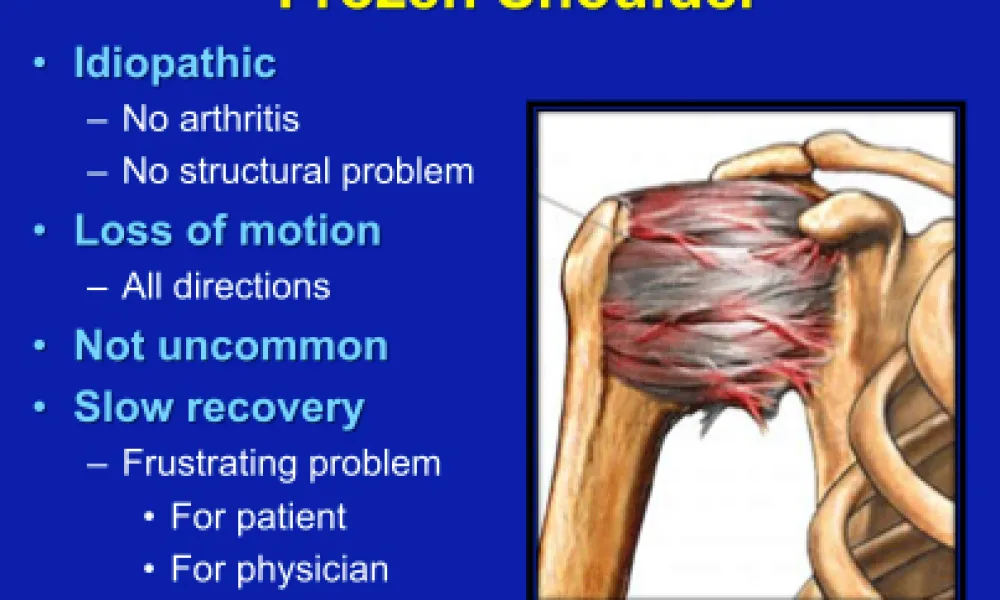 Painful Conditions of the Shoulder Presentation
