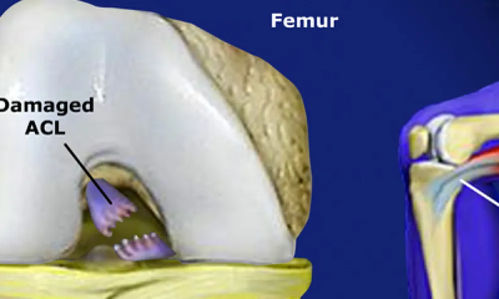 New Patient Education Videos!