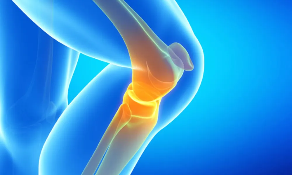 Does Robotic Guidance Improve Knee Replacement?