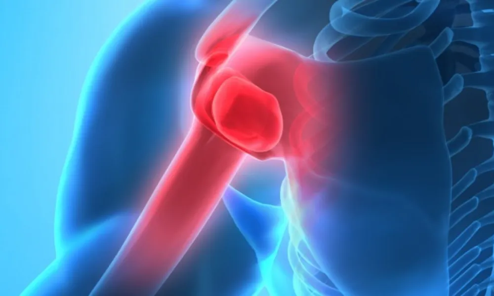 Rotator cuff problems a common cause of shoulder pain: Orthopedic