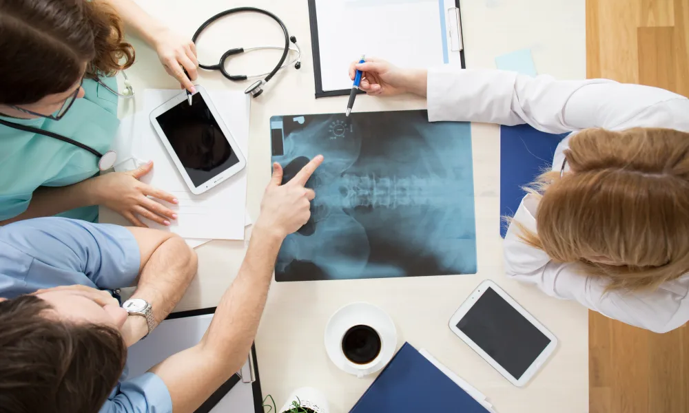 Doctors gathered around X-ray film