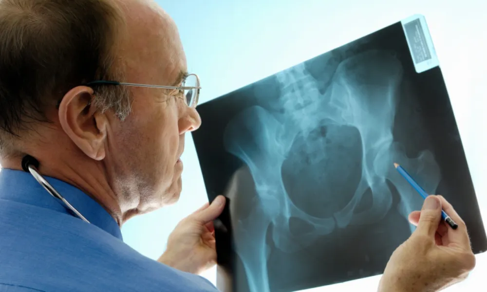 Total Hip Replacement Surgery: The Process