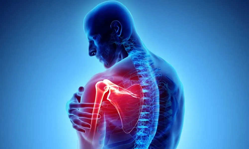Shoulder Pain Caused by Rotator Cuff Tears