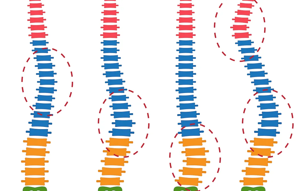Scoliosis Treatment Orthopaedic Specialists of Austin