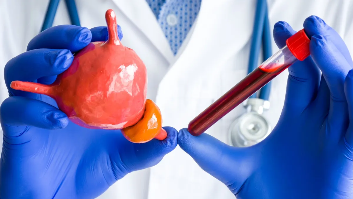 Doctor wearing blue gloves holding a bladder model and a blood sample tube in a medical setting