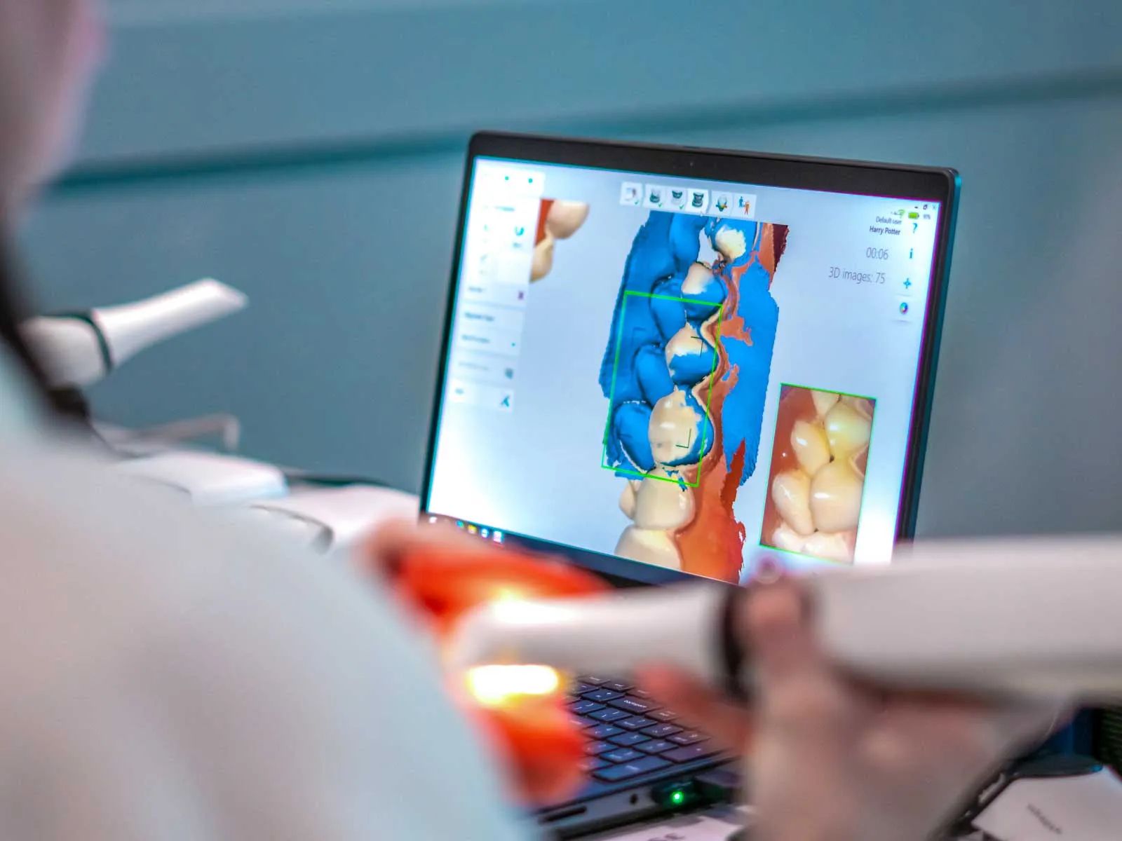 Dental professional using digital scanner and software to create 3D model of patient's teeth for treatment planning