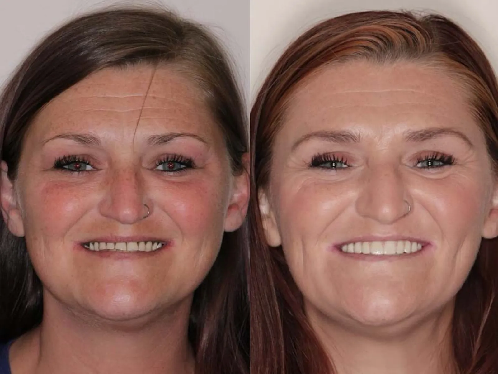 woman before after