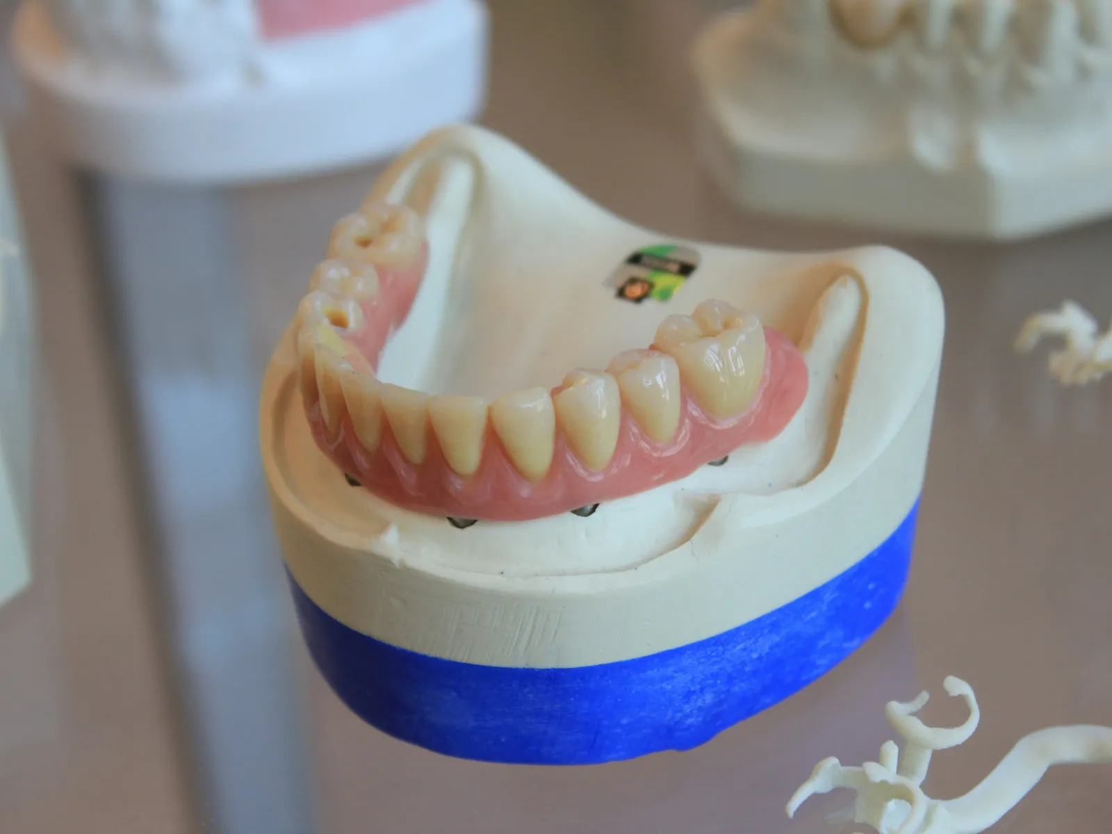Dental implant model showing lower jaw with artificial teeth on a blue and white base.