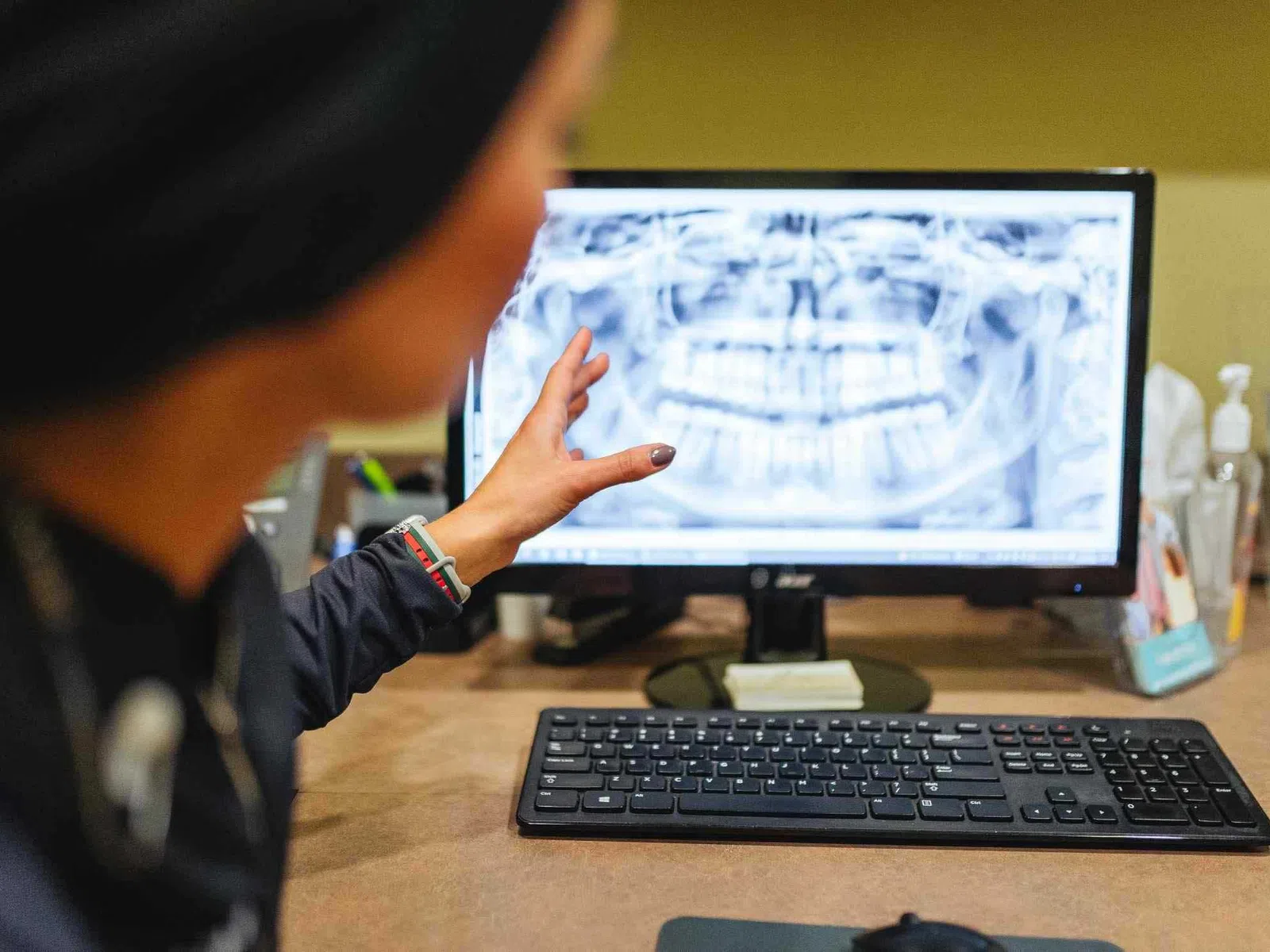 Dentist pointing at a dental X-ray displayed on a computer screen in a clinical setting.