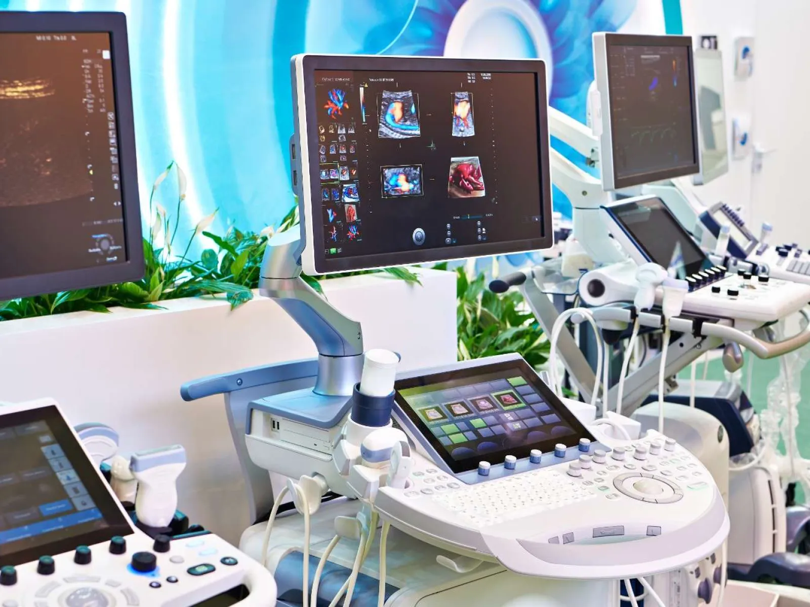 Advanced medical ultrasound machines with multiple monitors displaying diagnostic images in a clinical setting.