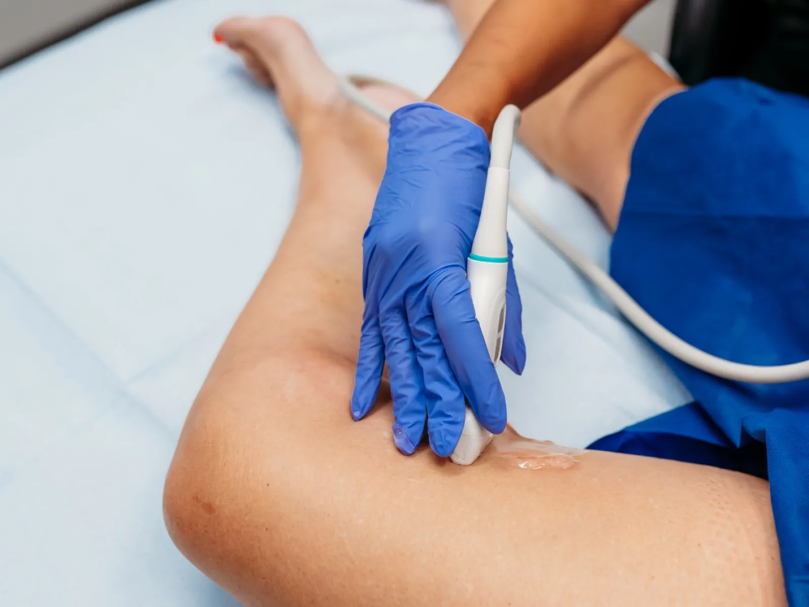 Close-up of medical professional performing ultrasound on patient's leg with gel and transducer.