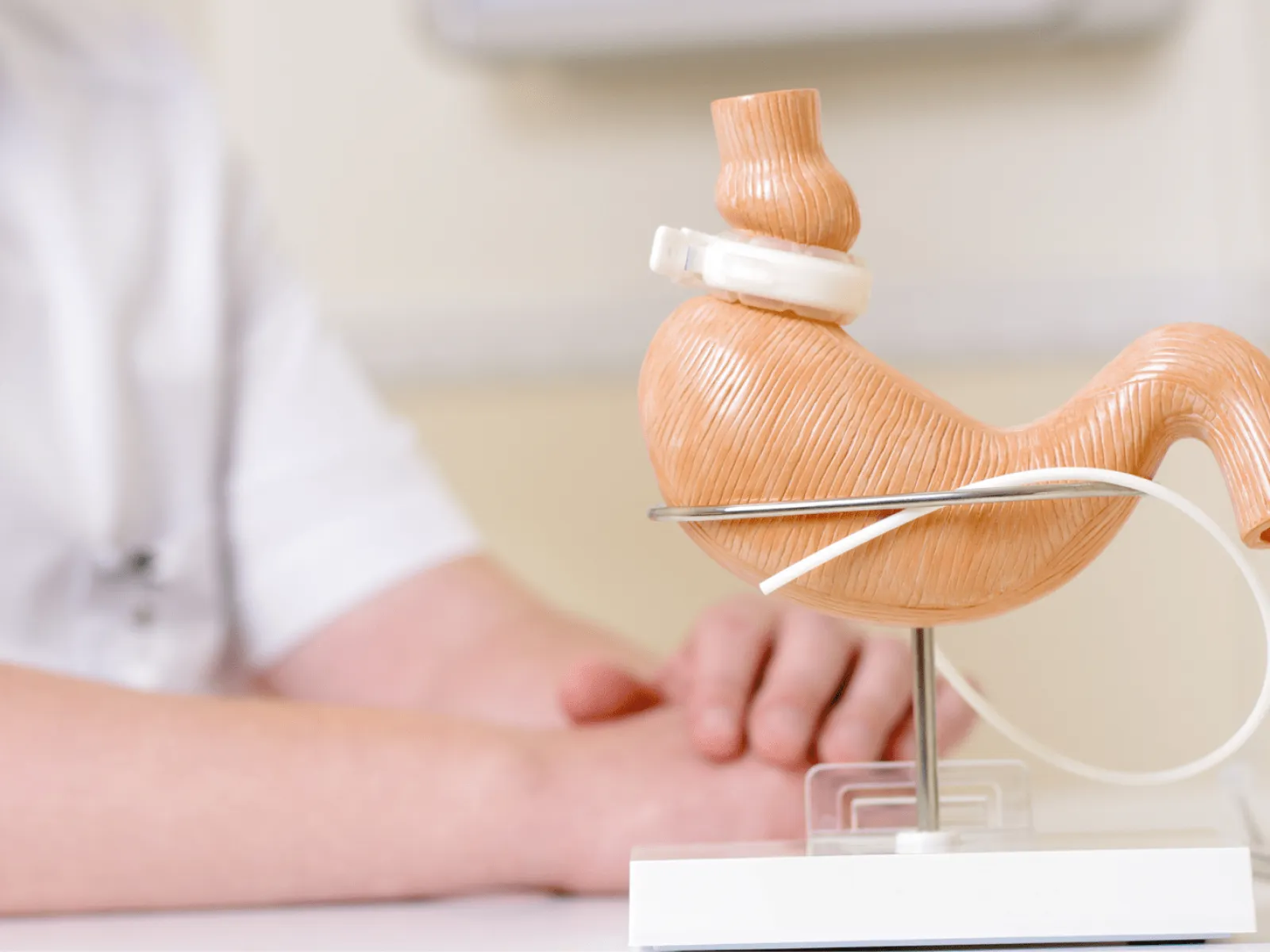 Medical model of a stomach with a gastric band in front of a doctor in a white coat.