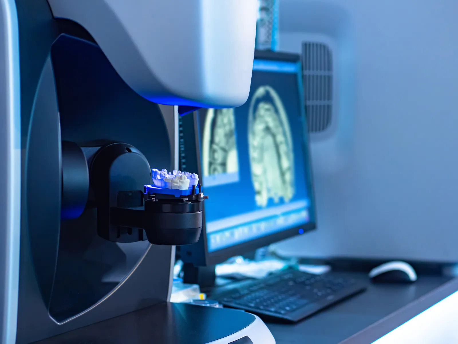 Dental 3D scanner scanning dental mold with dental X-ray images on computer screen in background