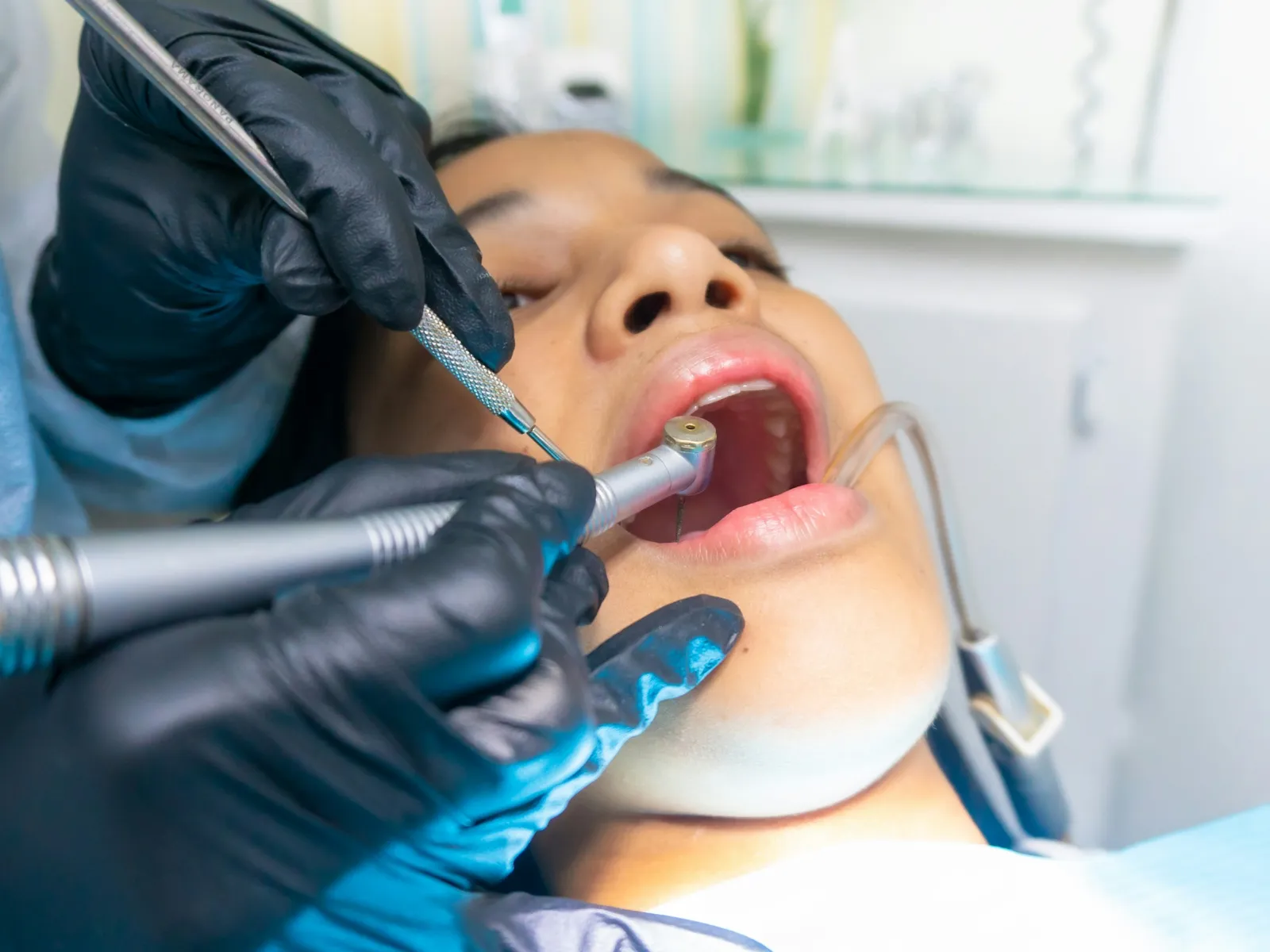 Close-up of a dentist wearing gloves performing dental treatment on a patient in a dental clinic.