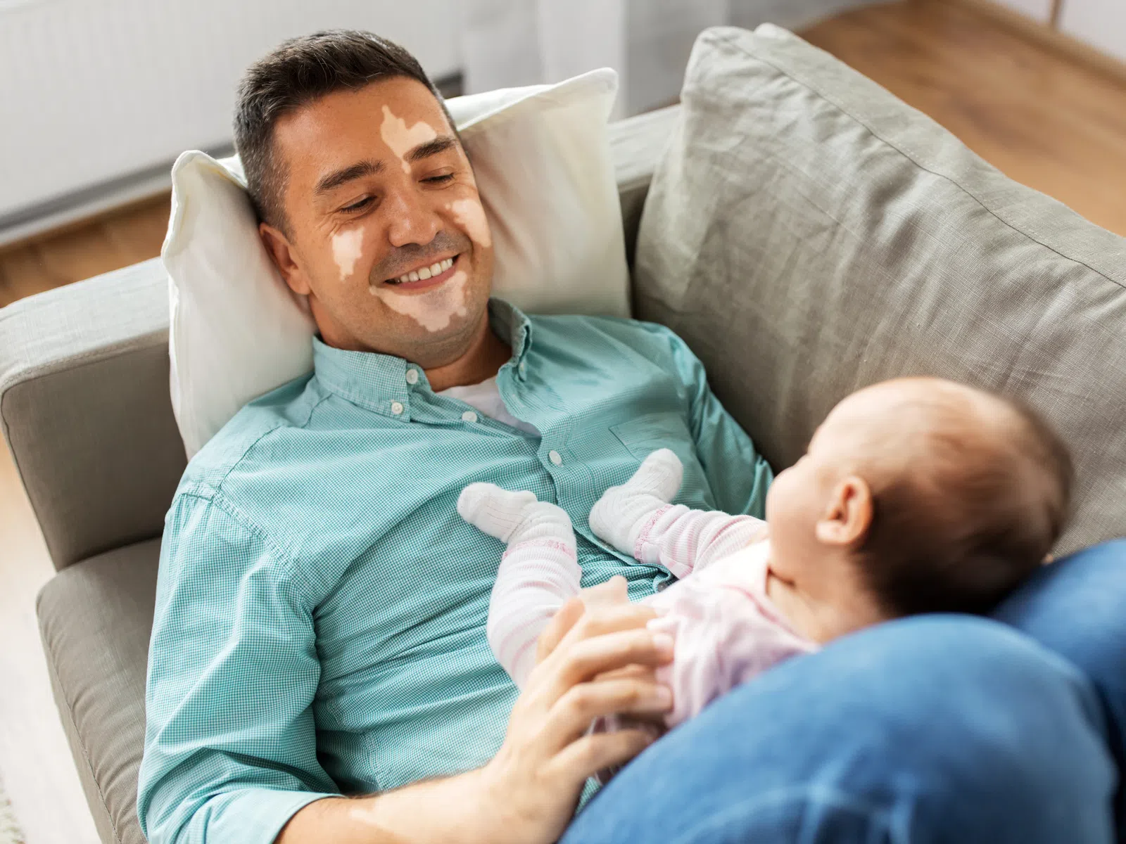Father with vitiligo lying on couch, smiling and holding baby dressed in pink indoors, showing loving bonding moment.