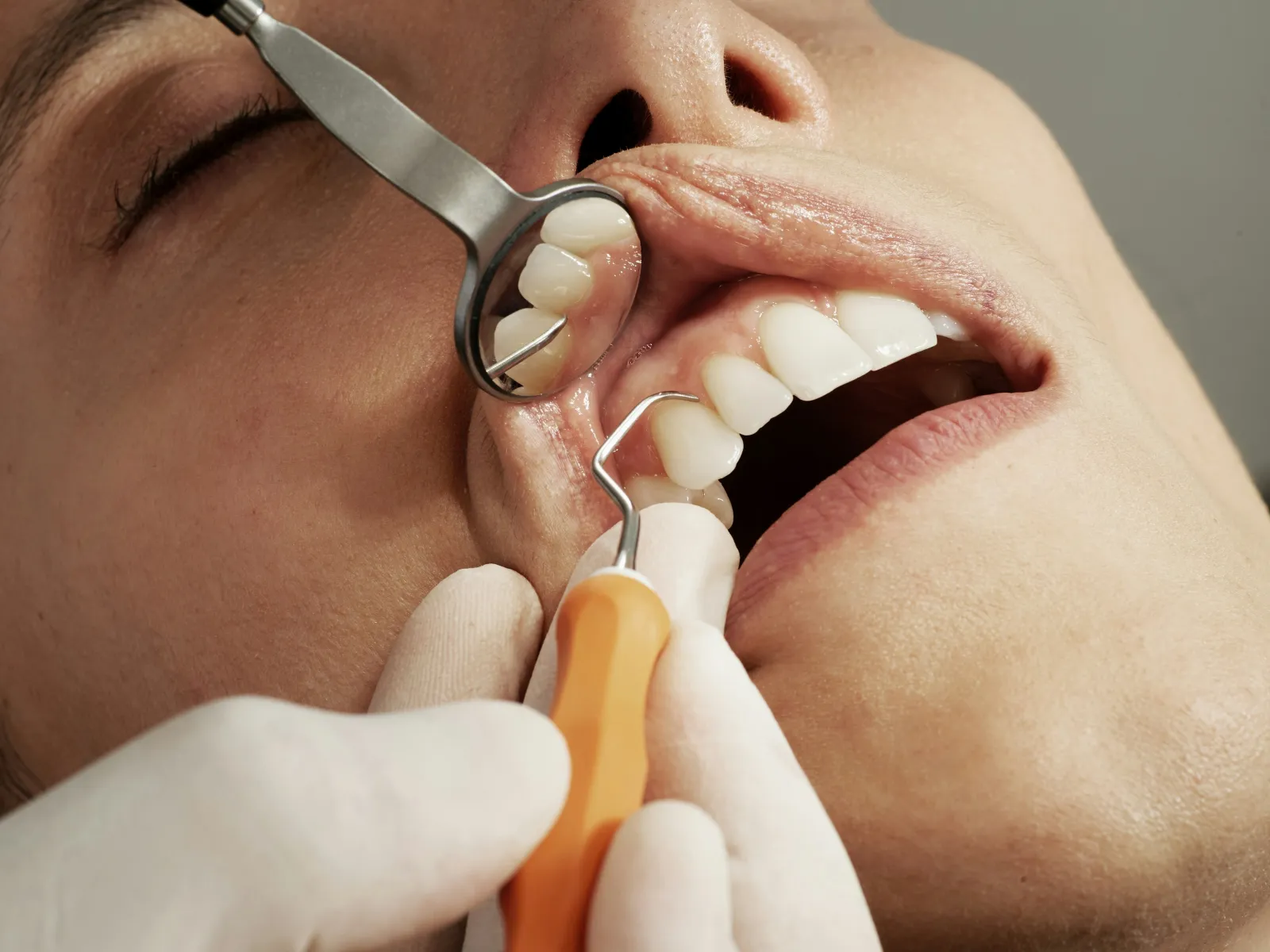 a dentist examining a patient's teeth