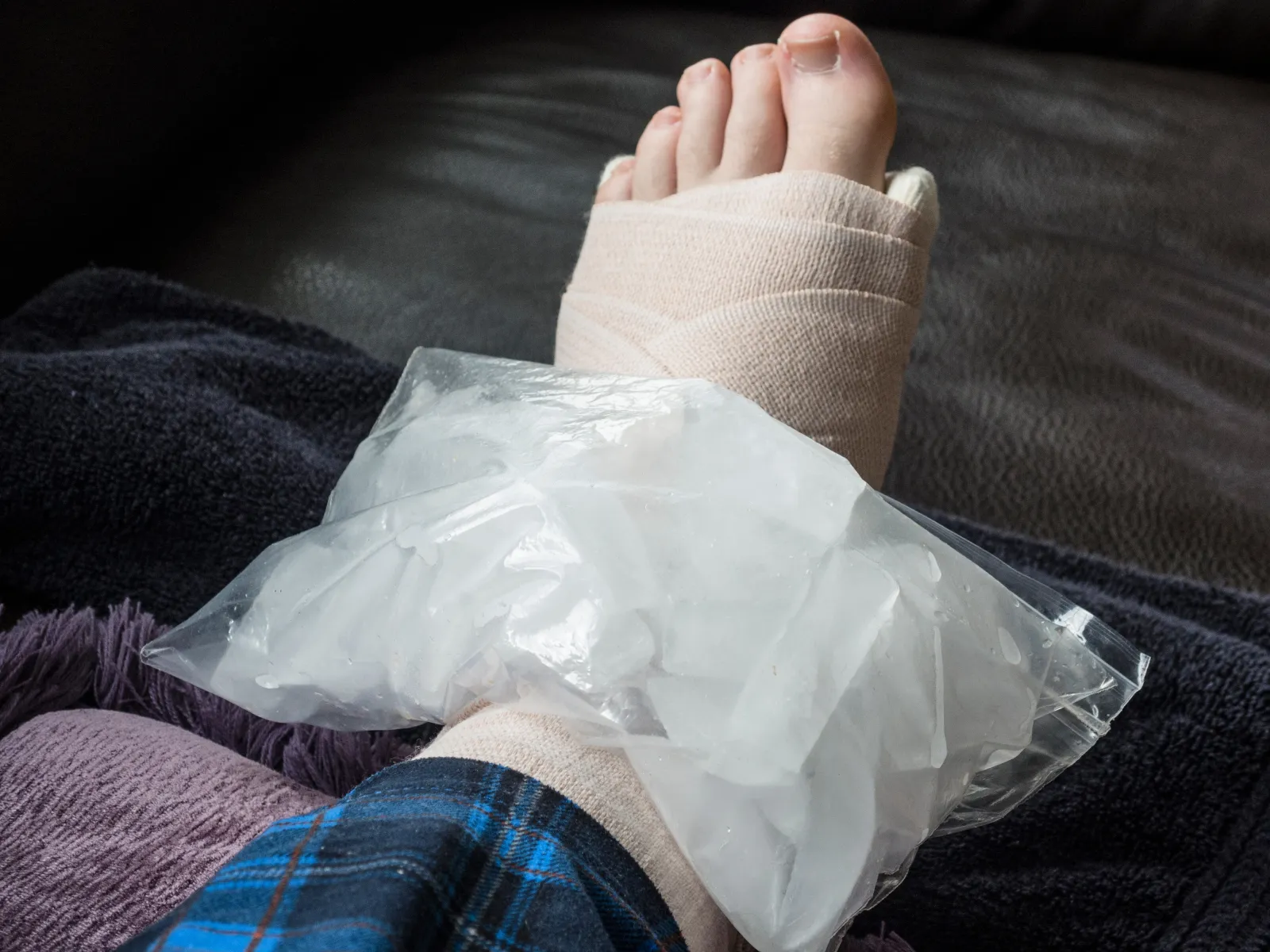 Foot wrapped in bandage with ice pack on ankle for injury relief and swelling reduction.
