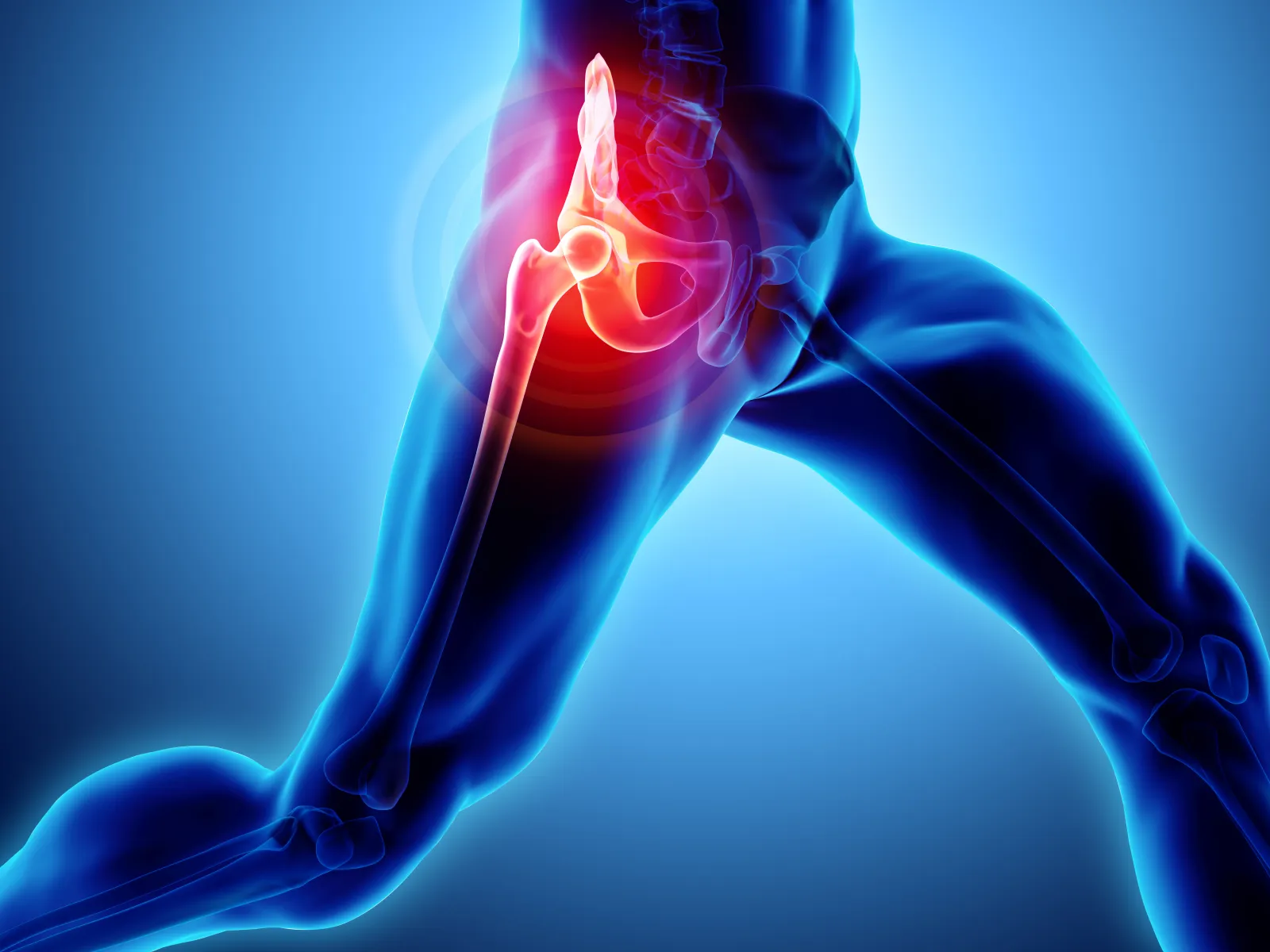 3D illustration of human hip joint pain showing inflammation in the hip bone and surrounding area