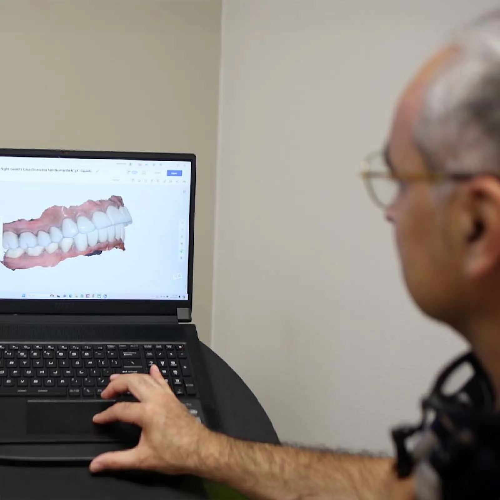 Dentist analyzing 3D dental model on laptop showing detailed teeth and gum structure during consultation.