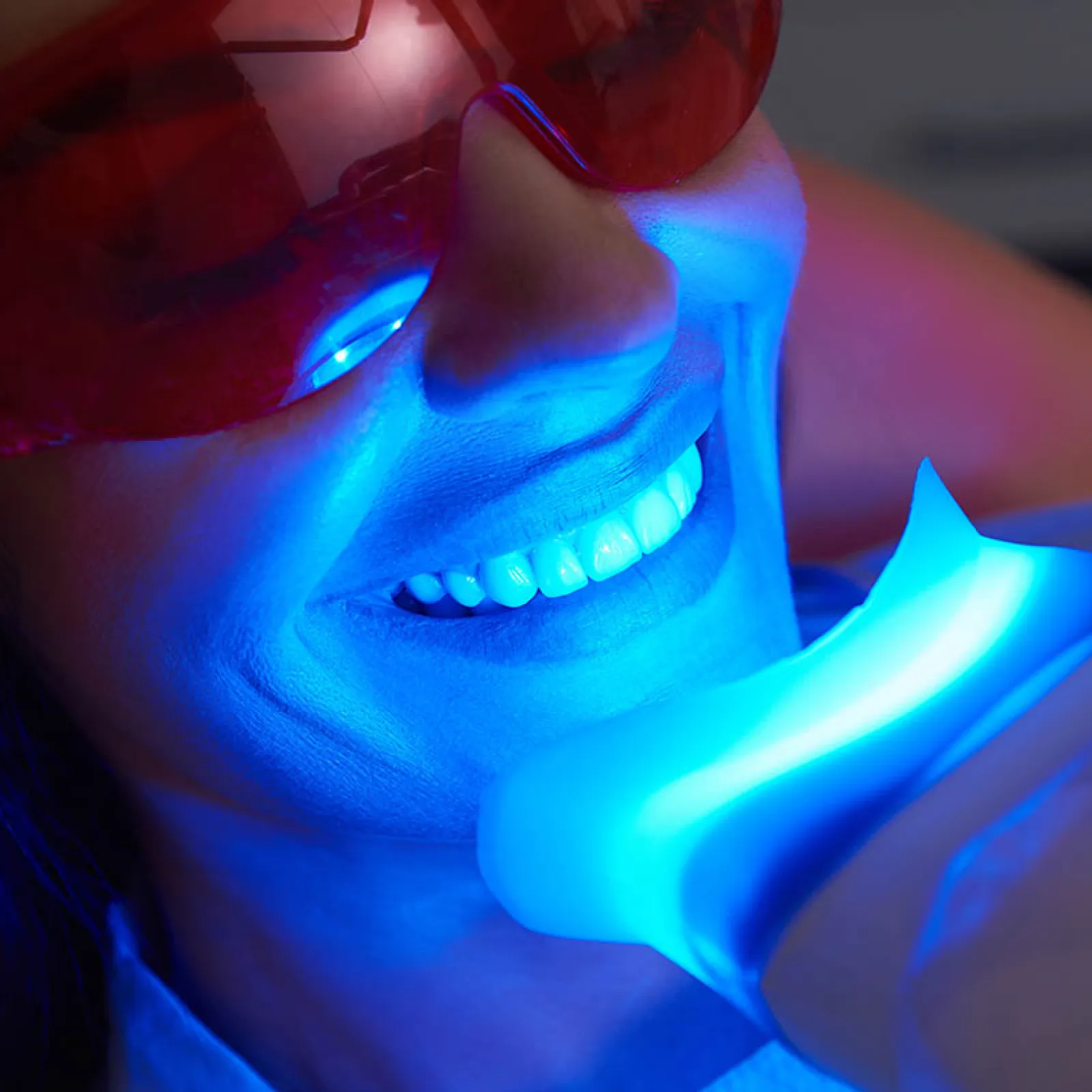 Close-up of woman wearing red protective glasses undergoing blue light teeth whitening treatment.
