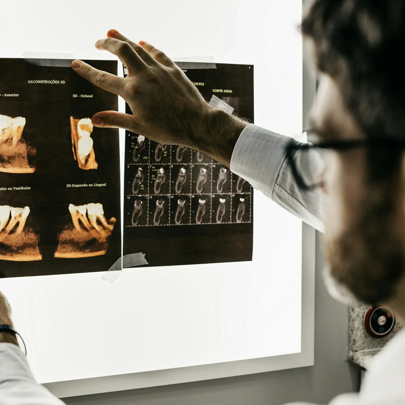 a man pointing at a picture on a white board