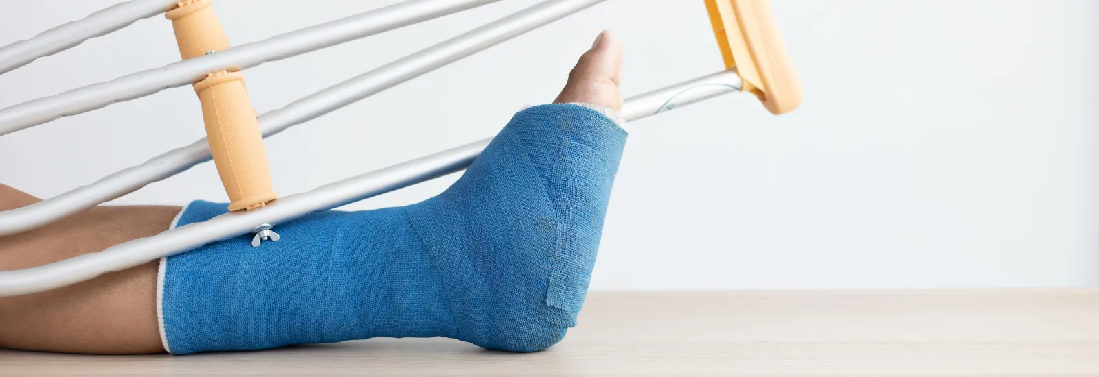 New in a Plaster Cast? Advice On How To Speed Up Recovery