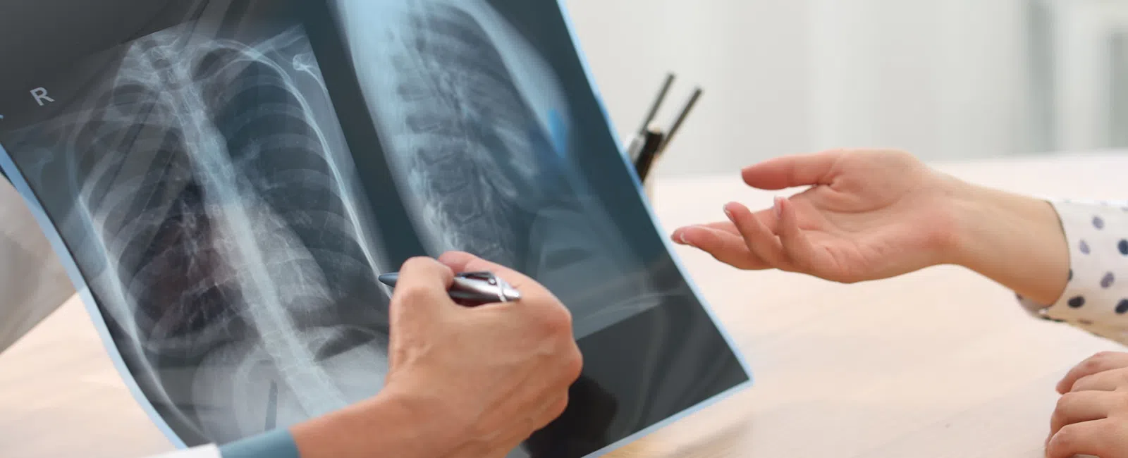 Doctor reviewing and explaining chest X-ray results to patient during medical consultation.