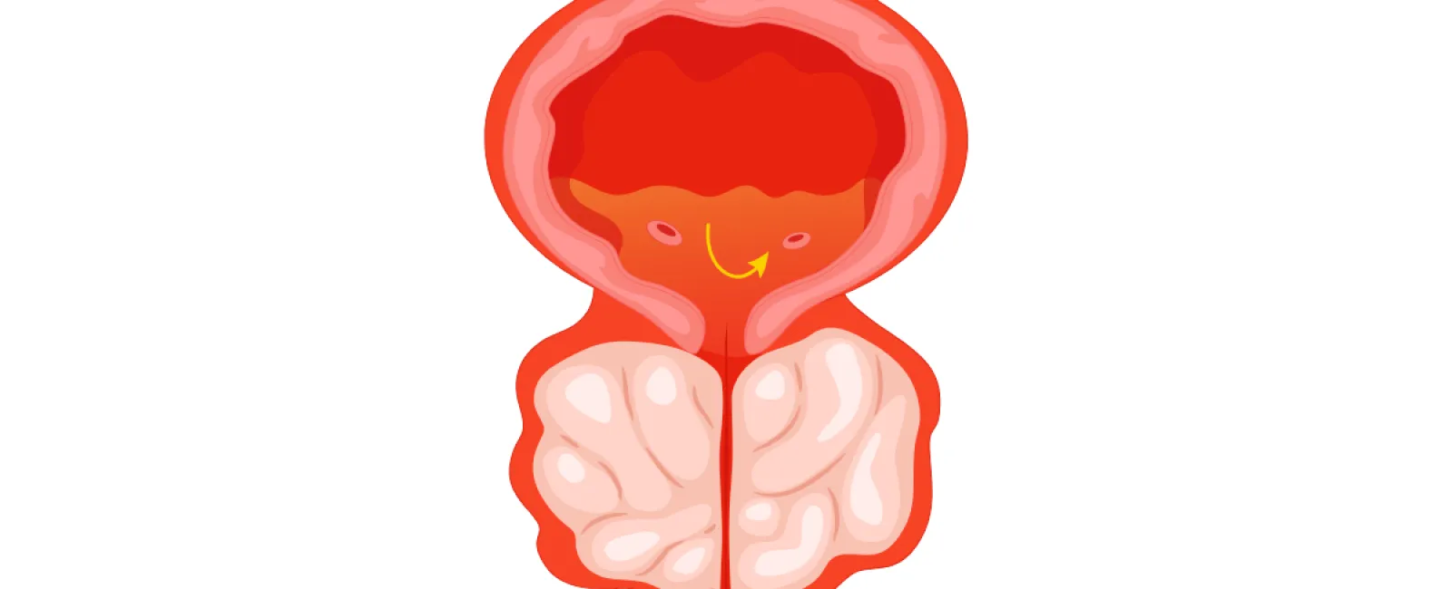 Illustration of a human prostate gland highlighting internal anatomy in red and pink shades on a white background.