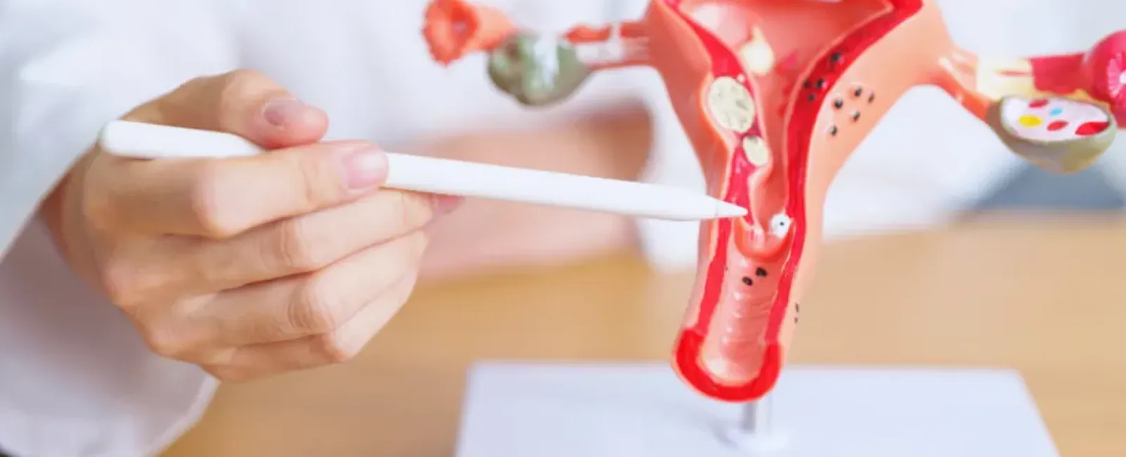 Medical professional pointing at a uterus anatomical model with a pen tip on a desk.
