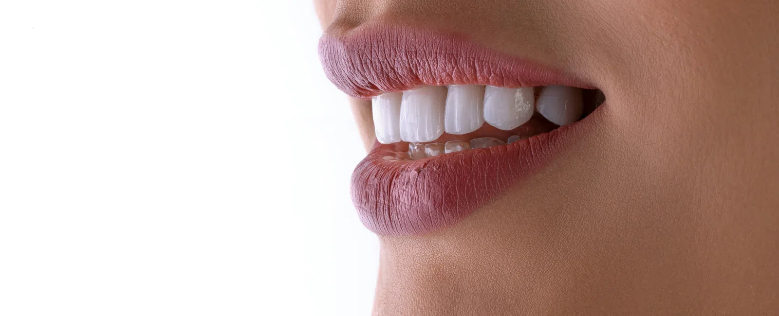 Close-up of smiling lips with natural pink lipstick and white teeth against a white background.
