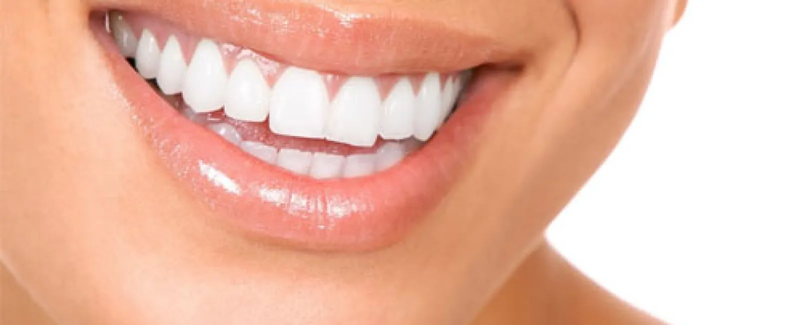 5 Tips on Avoiding Gum Disease