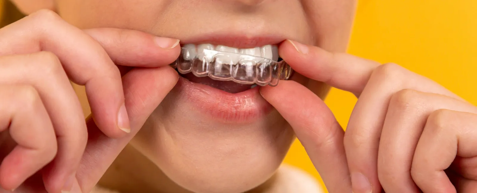 Person placing a clear dental aligner onto their upper teeth against a yellow background.