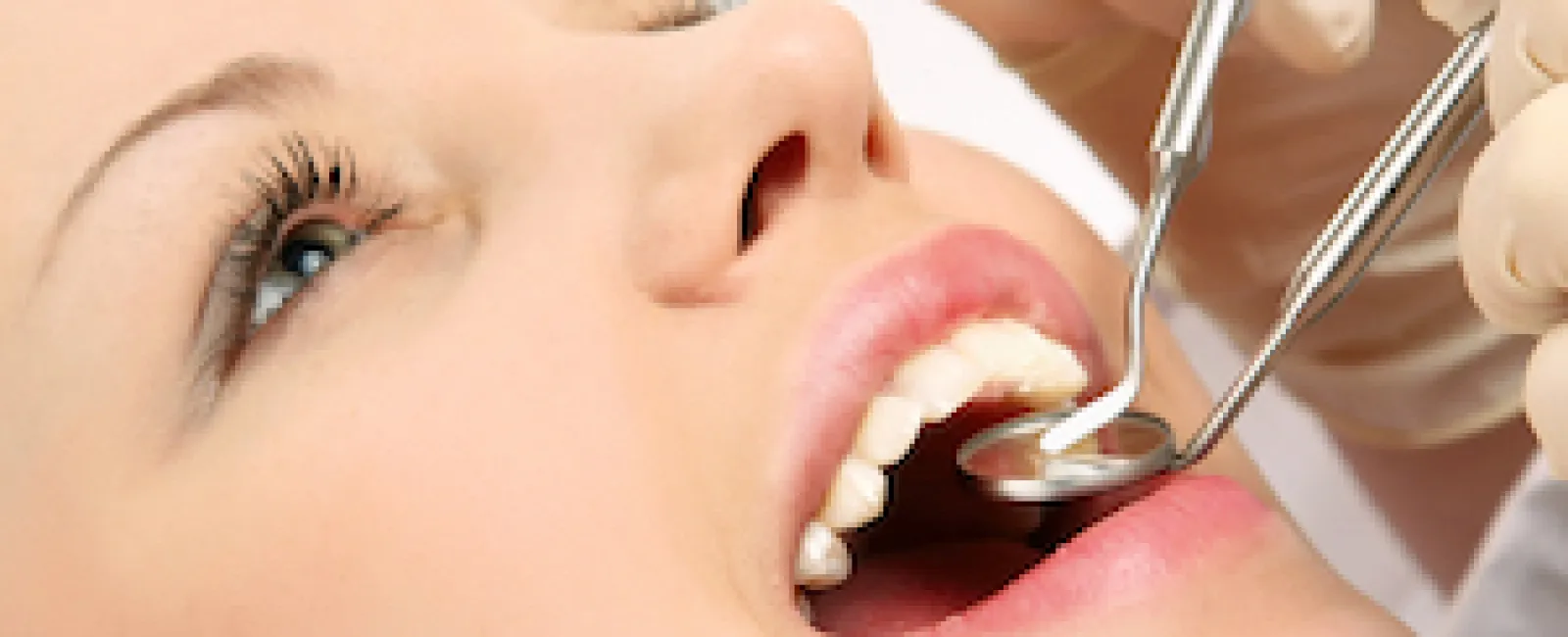 Get Two Dental Cleanings Next Year