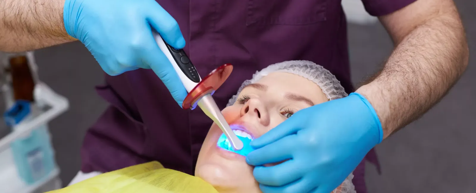 What are Dental Sealants?
