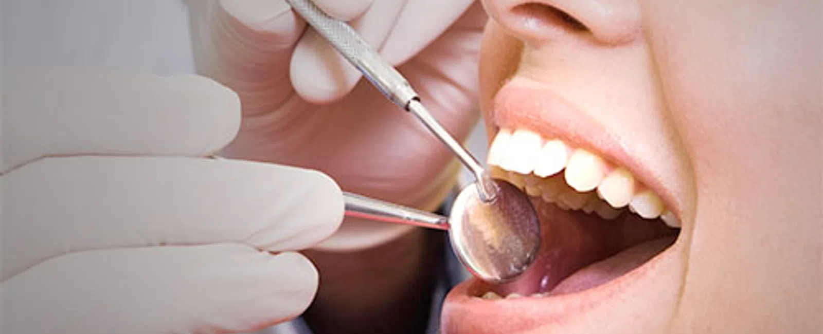 Close-up of dental examination showing dentist's gloved hands using tools inside patient's open mouth