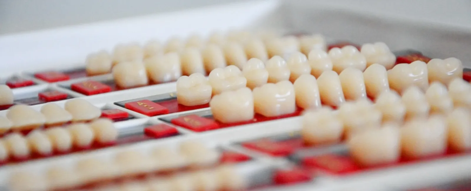 The Ultimate Guide to Porcelain Veneers: Cost, Procedure, and Benefits