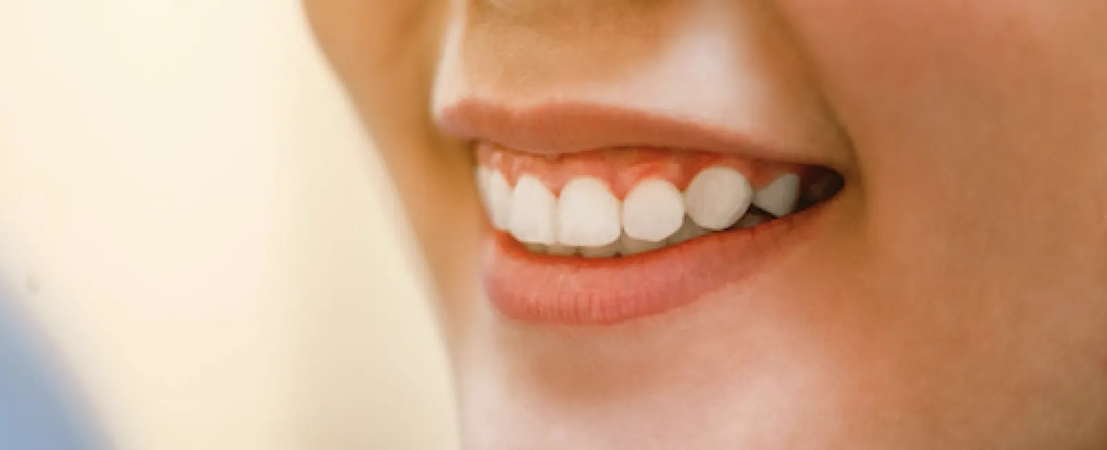 Unveil Your Best Smile With Gummy Smile Treatment in Oakhurst