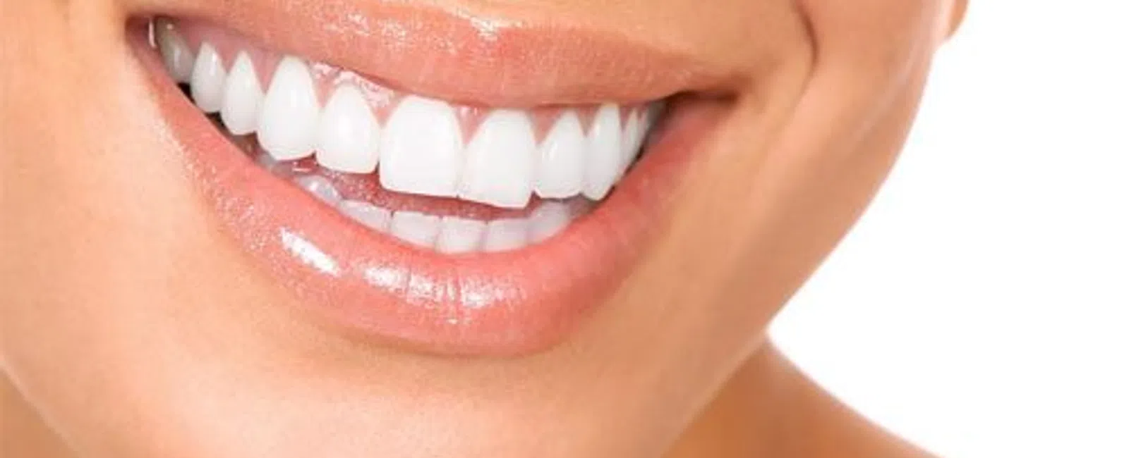 Close-up of a smiling person showing clean, white teeth and glossy lips against a white background