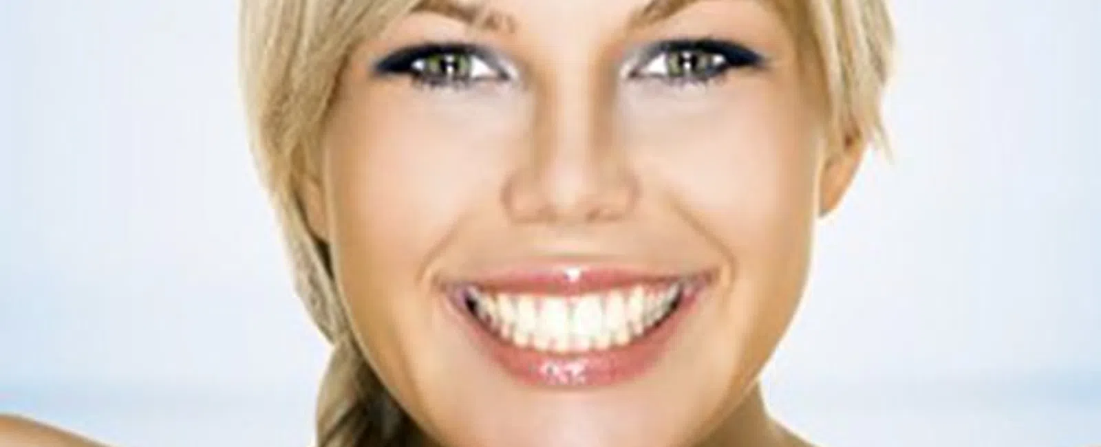 Dental Veneers Can Dramatically Improve Your Look