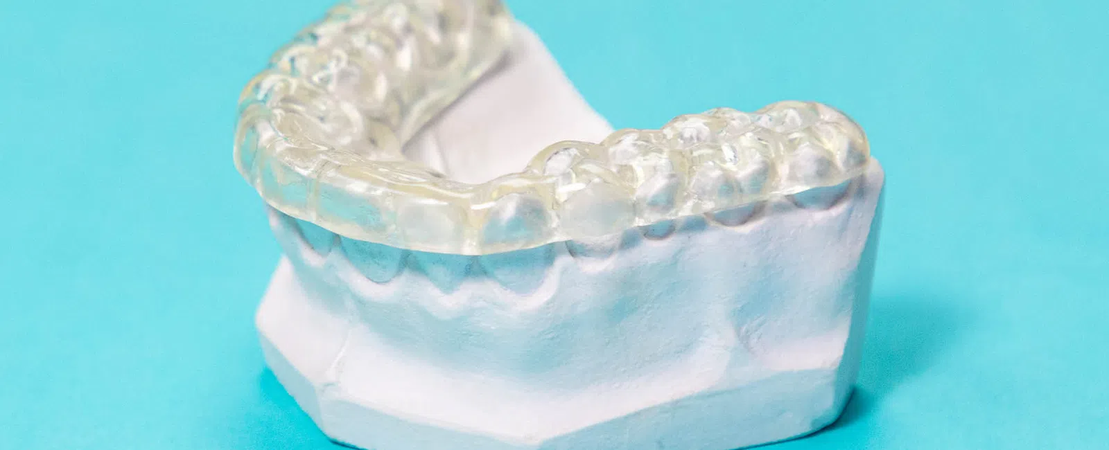 Clear dental aligner placed on a white plaster dental mold on a blue background