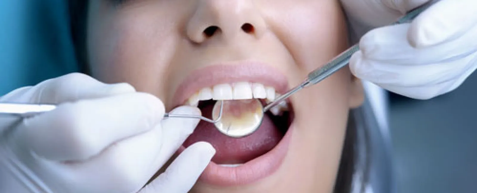 A Spring Dental Cleaning Will Brighten Your Smile