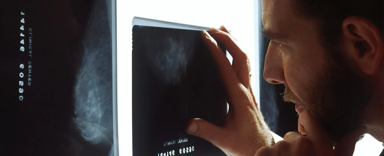 Doctor closely examining breast cancer mammogram X-ray film on lightbox for diagnosis.