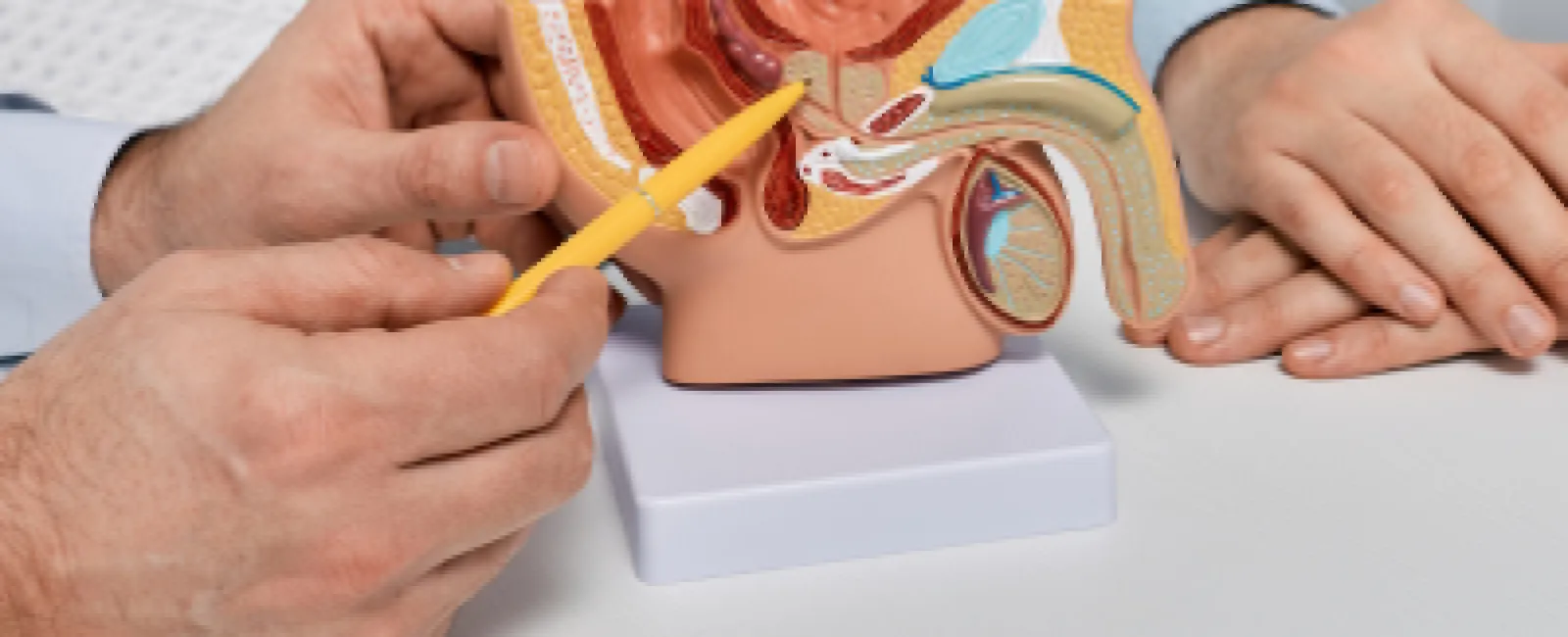 Doctor using a prostate model to explain prostate cancer treatment options to a patient.