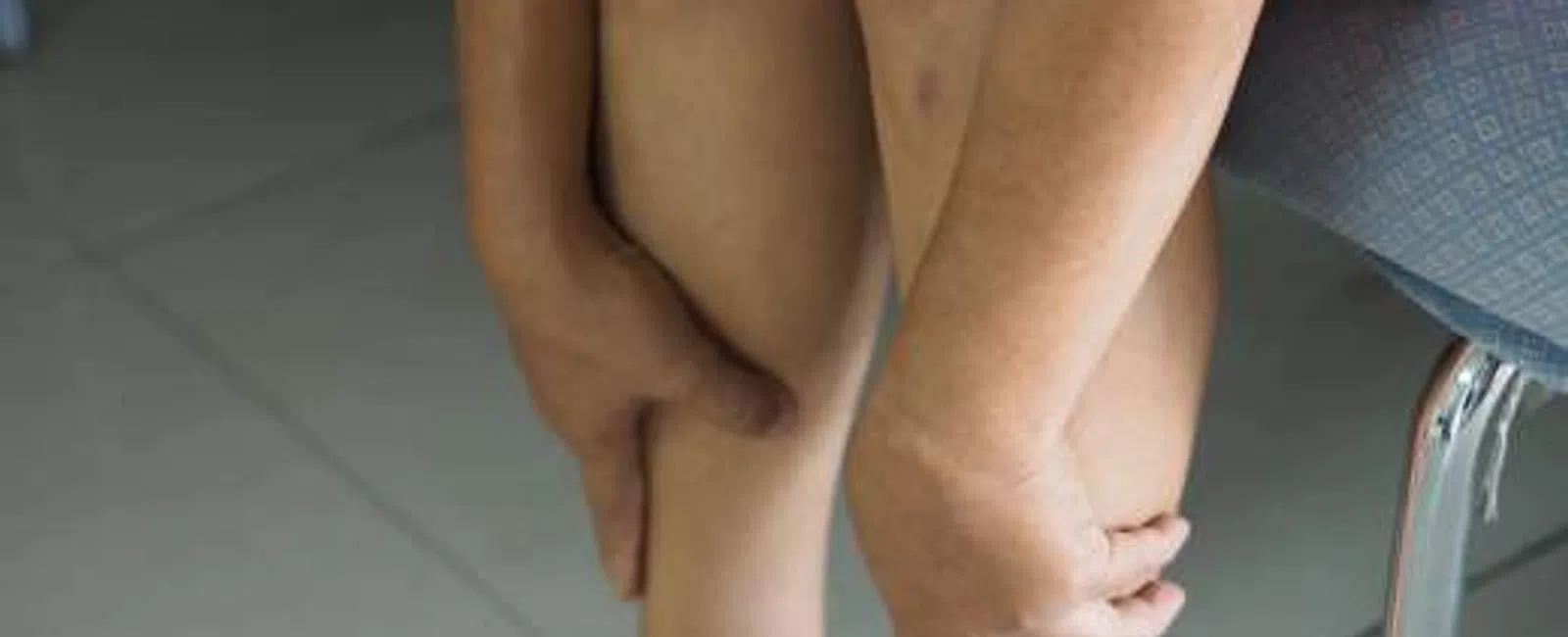 How to Relieve Painful Varicose Veins: Real Answers That Actually Help